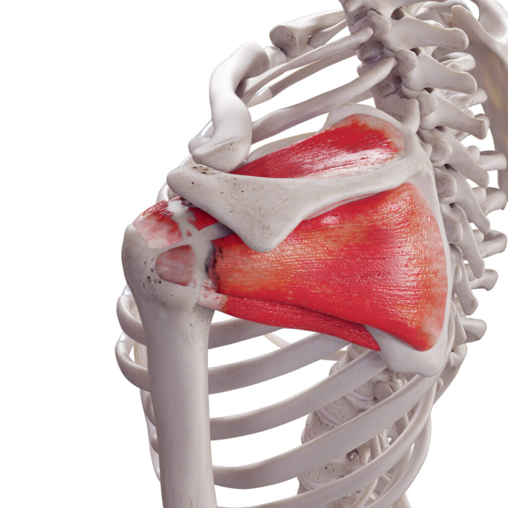 Rotator Cuff Tear