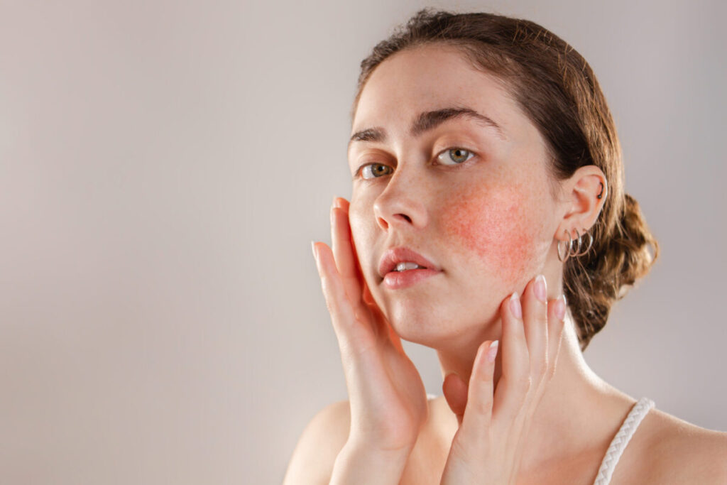 Get trusted legal help for skin condition claims?